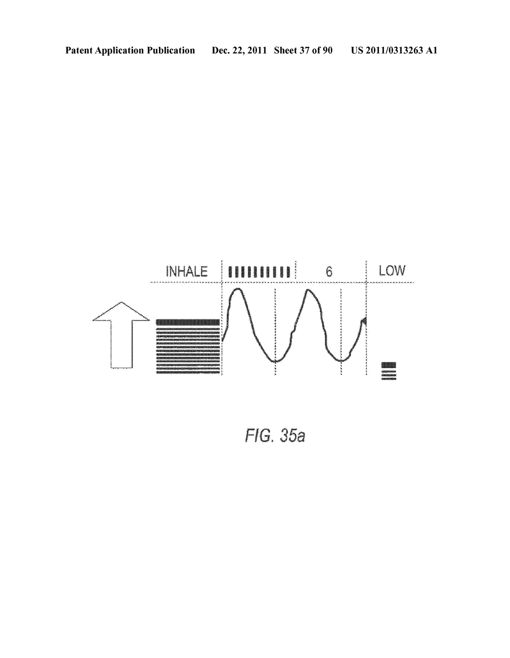 METHODA AND DEVICES FOR RELIEVING STRESS - diagram, schematic, and image 38