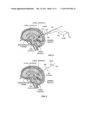 Ultrasound for Surgical Cranial Applications diagram and image