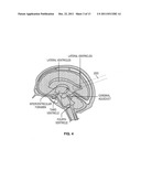 Ultrasound for Surgical Cranial Applications diagram and image