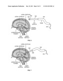 Ultrasound for Surgical Cranial Applications diagram and image