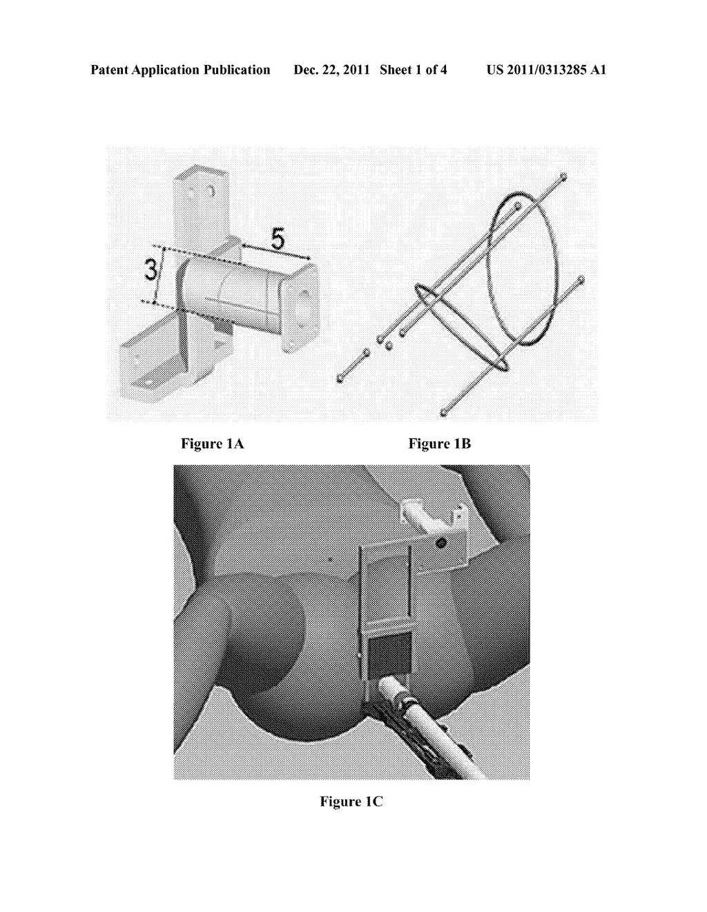 C-ARM POSE ESTIMATION USING INTENSITY-BASED REGISTRATION OF IMAGING     MODALITIES - diagram, schematic, and image 02