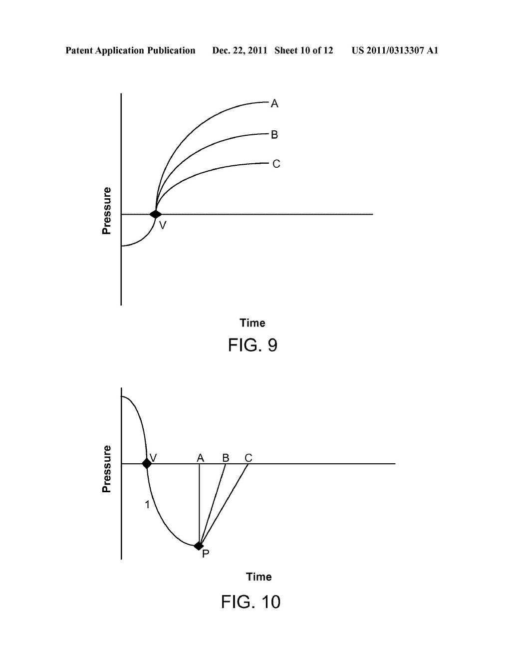 MEASURING LUNG FUNCTION AND LUNG DISEASE PROGRESSION AT A LOBAR/SEGMENTAL     LEVEL - diagram, schematic, and image 11