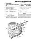 Methods and apparatus for dissolving blockages in intracranial catheters diagram and image