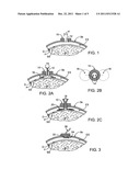 Methods and apparatus for dissolving blockages in intracranial catheters diagram and image