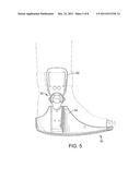 ADJUSTABLE ORTHOPEDIC BOOT diagram and image