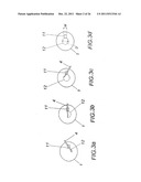 Method for treating refractive errors and vision disorders of an eye diagram and image