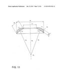 Method for treating refractive errors and vision disorders of an eye diagram and image