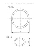 Method for treating refractive errors and vision disorders of an eye diagram and image