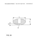 Method for treating refractive errors and vision disorders of an eye diagram and image