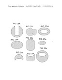 Method for treating refractive errors and vision disorders of an eye diagram and image