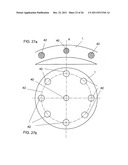 Method for treating refractive errors and vision disorders of an eye diagram and image