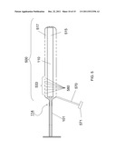 PHOTODYNAMIC BONE STABILIZATION AND DRUG DELIVERY SYSTEMS diagram and image