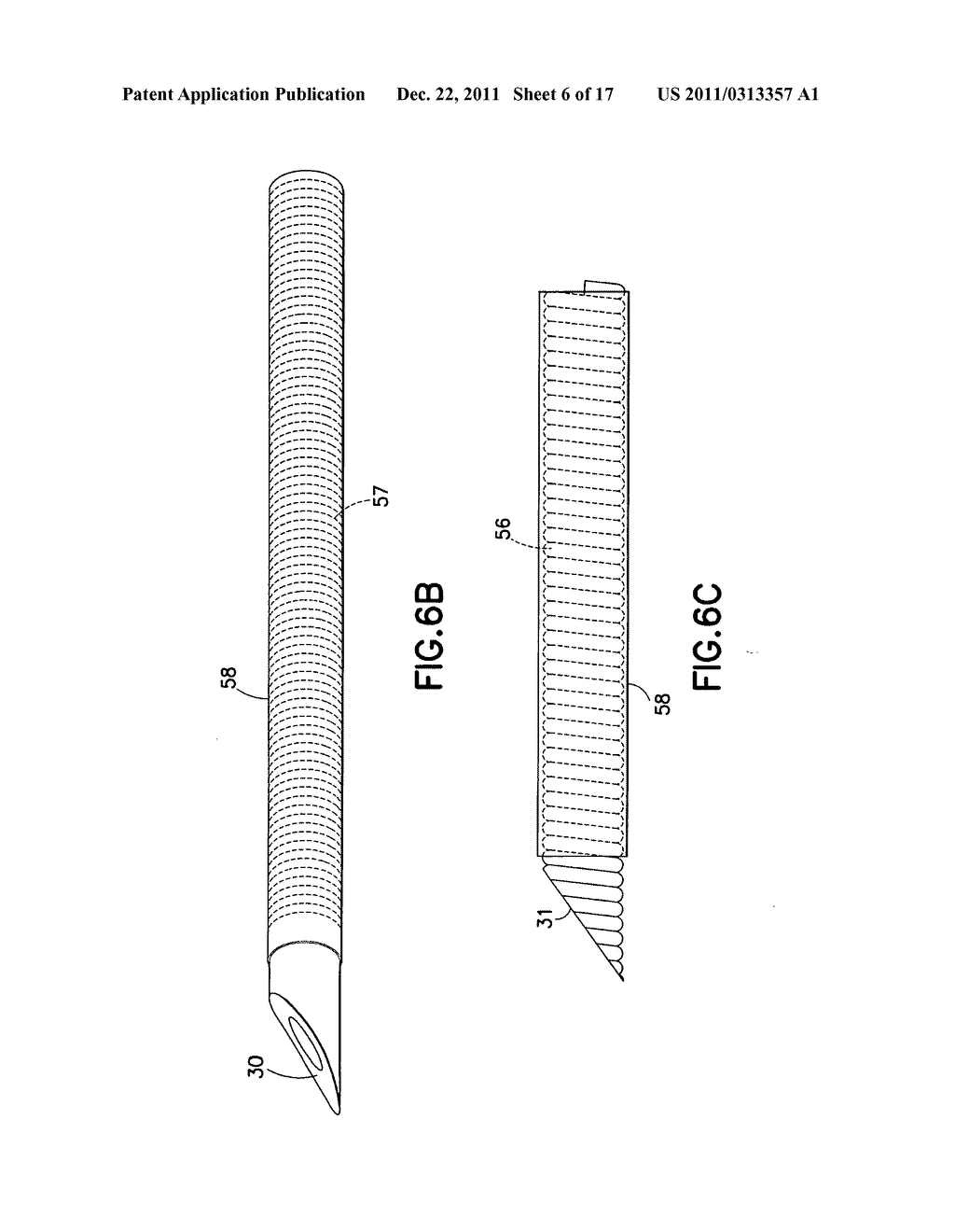 INFUSION SET AND/OR PATCH PUMP HAVING AT LEAST ONE OF AN IN-DWELLING RIGID     CATHETER WITH FLEXIBLE FEATURES AND/OR A FLEXIBLE CATHETER ATTACHMENT - diagram, schematic, and image 07