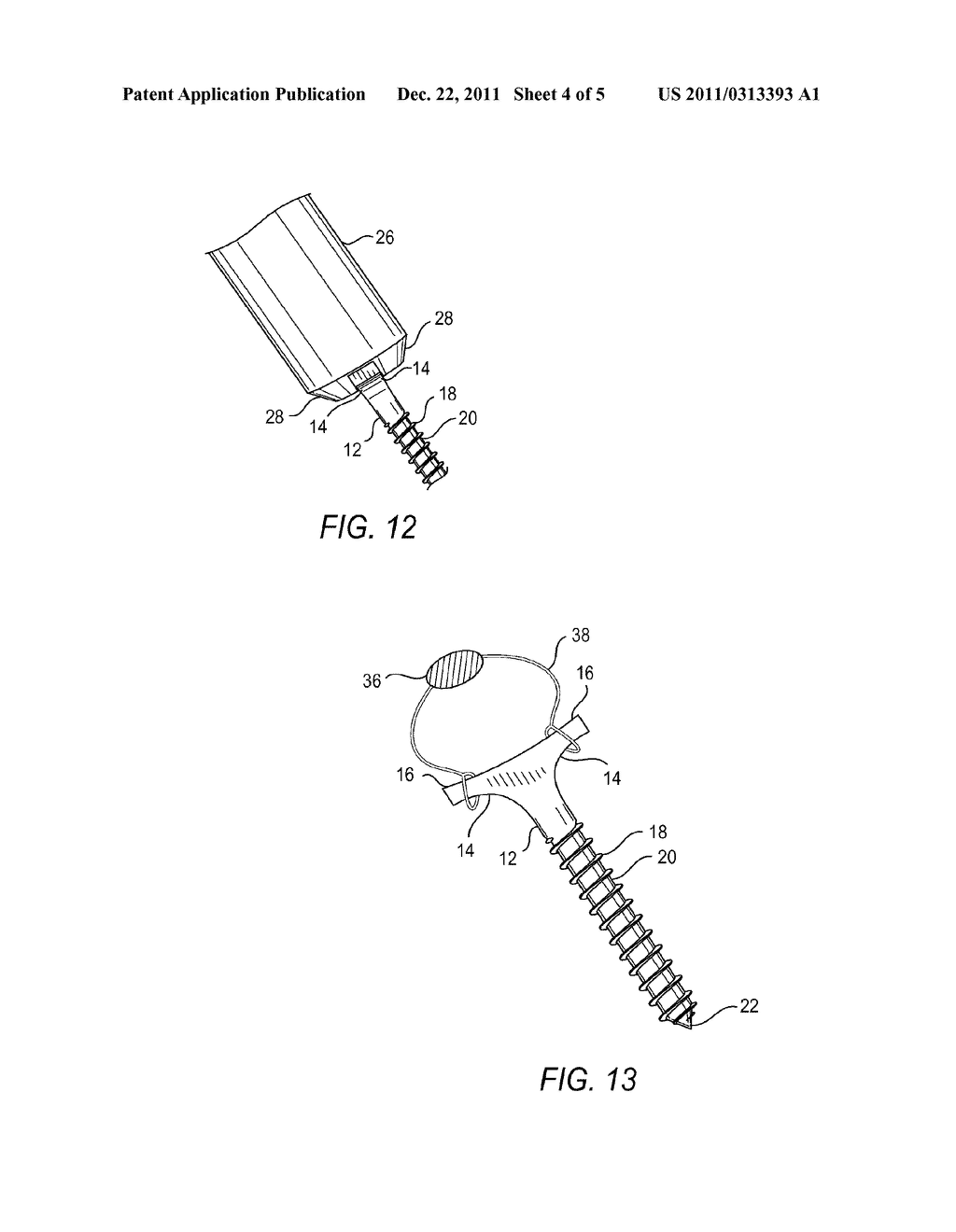 Implantable Device and Method for Delivering Drug Depots to a Site Beneath     the Skin - diagram, schematic, and image 05