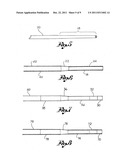 CATHETER GUIDE diagram and image