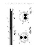 CATHETER GUIDE diagram and image