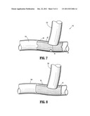 HEMOSTATIC PATCH diagram and image