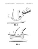 HEMOSTATIC PATCH diagram and image