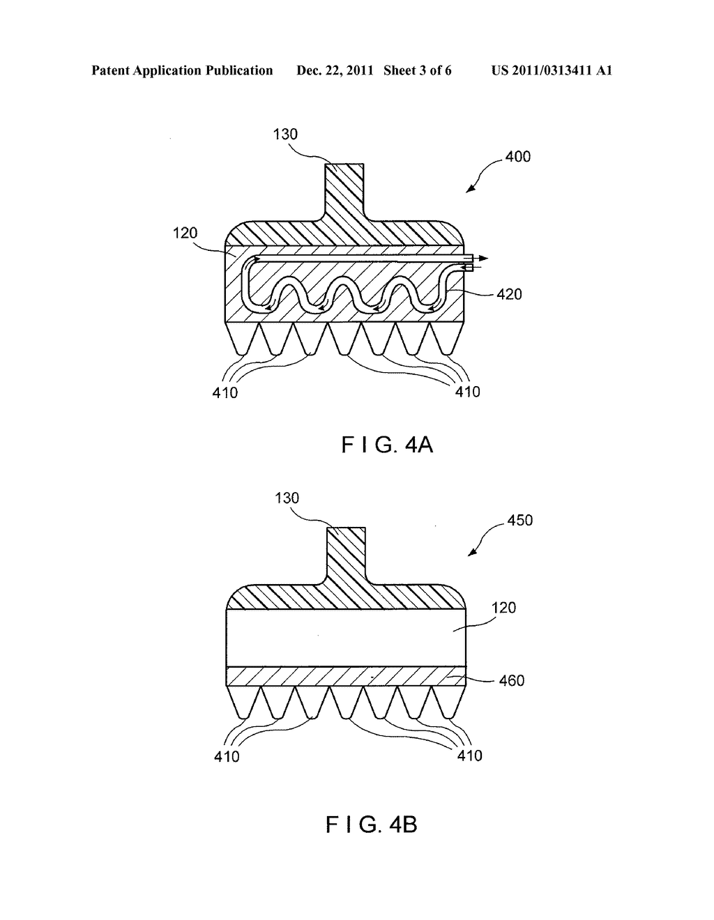 METHOD AND APPARATUS FOR DERMATOLOGICAL HYPOPIGMENTATION - diagram, schematic, and image 04