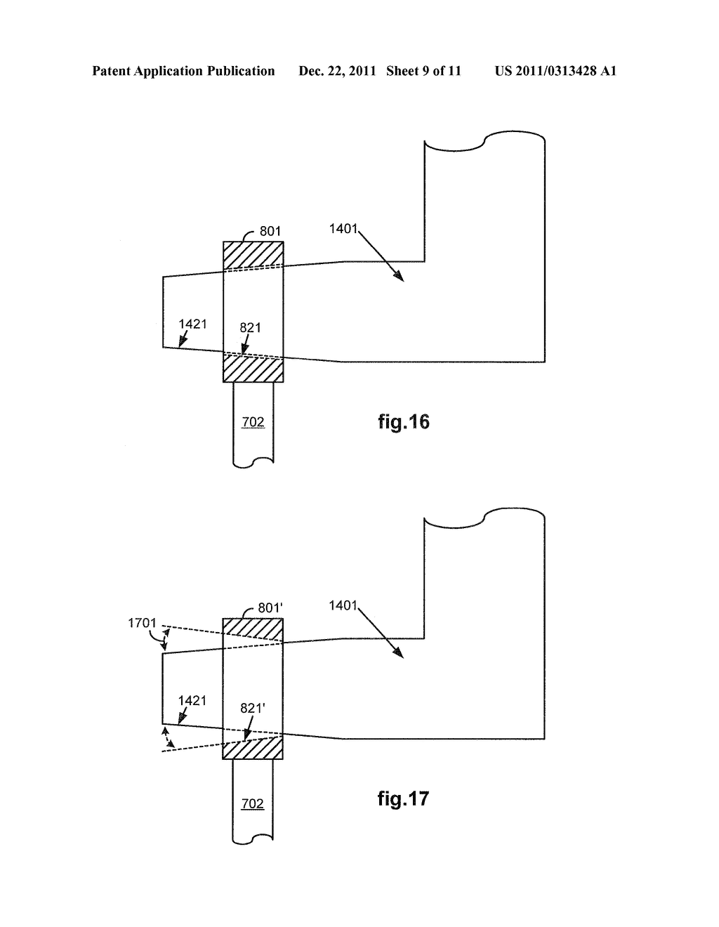 Bracing of Bundled Medical Devices for Single Port Entry, Robotically     Assisted Medical Procedures - diagram, schematic, and image 10