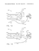 LAPAROSCOPIC SUTURE DEVICE WITH ASYNCHRONOUS IN-LINE NEEDLE MOVEMENT diagram and image