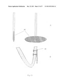 IN VIVO DEVICE FOR IMPROVING DIASTOLIC VENTRICULAR FUNCTION diagram and image