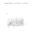 IN VIVO DEVICE FOR IMPROVING DIASTOLIC VENTRICULAR FUNCTION diagram and image