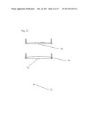 IN VIVO DEVICE FOR IMPROVING DIASTOLIC VENTRICULAR FUNCTION diagram and image