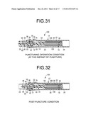 DISPOSABLE LANCING DEVICE diagram and image