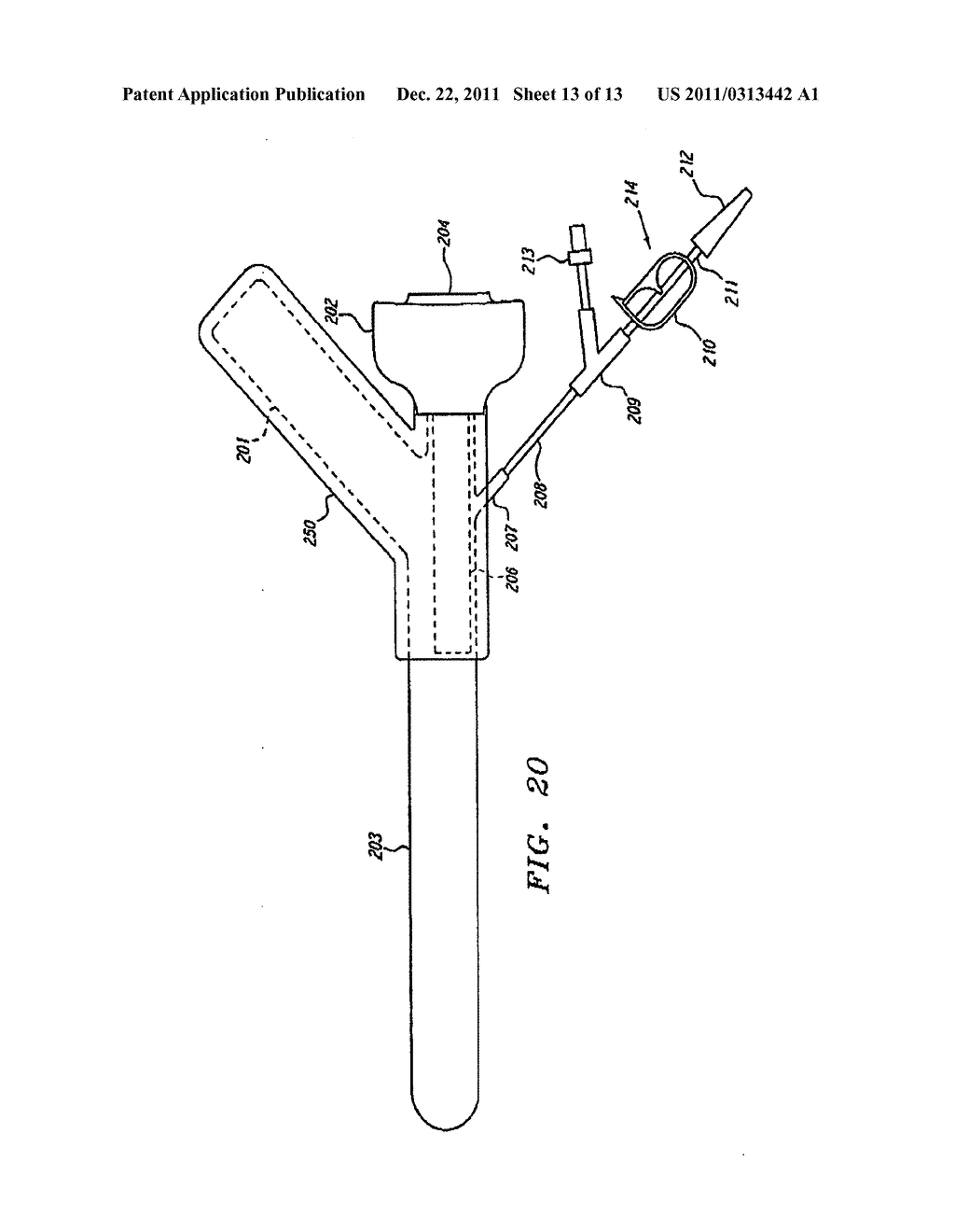 EXTRALUMINAL BALLOON DISSECTION - diagram, schematic, and image 14