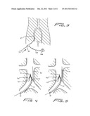 Method Of Removing A Vein Filter diagram and image