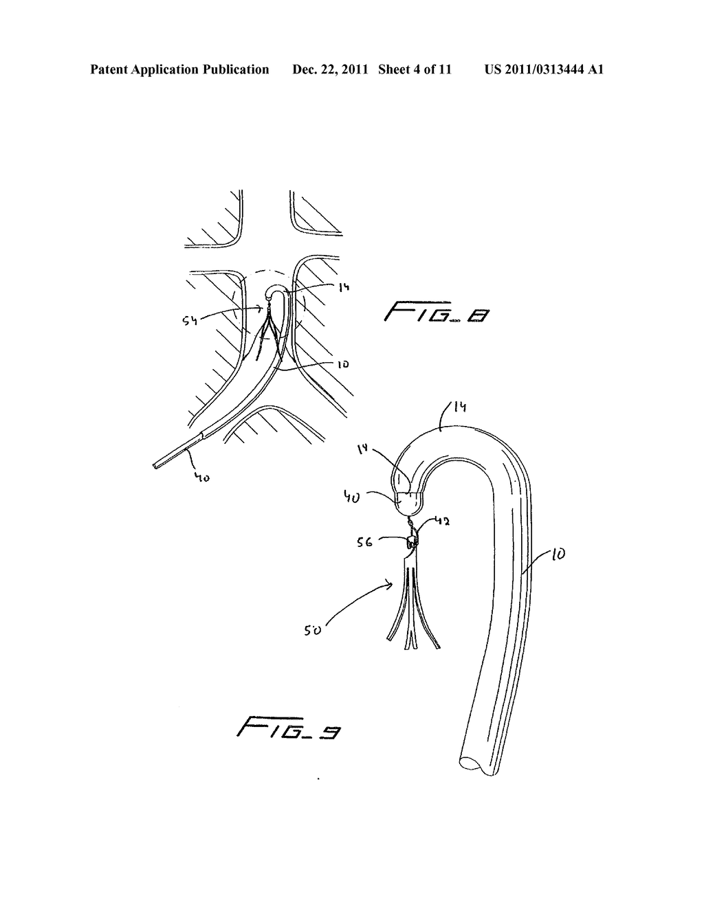 Method Of Removing A Vein Filter - diagram, schematic, and image 05