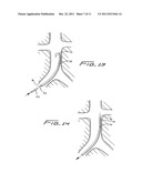 Method Of Removing A Vein Filter diagram and image