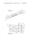 Method Of Removing A Vein Filter diagram and image