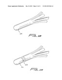 Method Of Removing A Vein Filter diagram and image