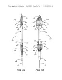 EMBOLIC PROTECTION DURING PERCUTANEOUS HEART VALVE REPLACEMENT AND SIMILAR     PROCEDURES diagram and image