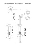 Cardiac Valve Procedure Methods and Devices diagram and image