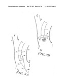 Cardiac Valve Procedure Methods and Devices diagram and image