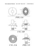 Cardiac Valve Procedure Methods and Devices diagram and image