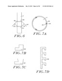 Cardiac Valve Procedure Methods and Devices diagram and image