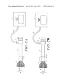 Cardiac Valve Procedure Methods and Devices diagram and image