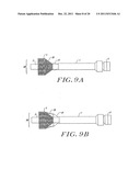 Cardiac Valve Procedure Methods and Devices diagram and image