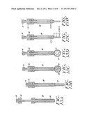 Cardiac Valve Procedure Methods and Devices diagram and image