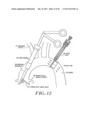 Cardiac Valve Procedure Methods and Devices diagram and image