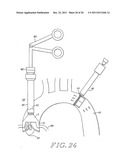 Cardiac Valve Procedure Methods and Devices diagram and image