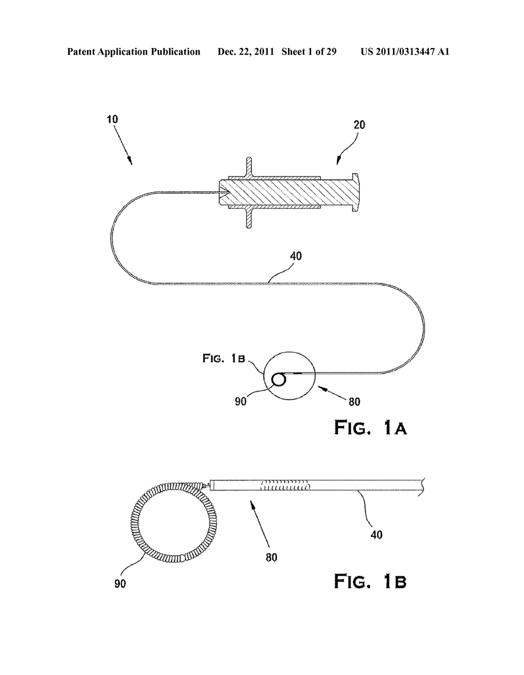 SYSTEM AND METHOD FOR MECHANICALLY POSITIONING INTRAVASCULAR IMPLANTS - diagram, schematic, and image 02