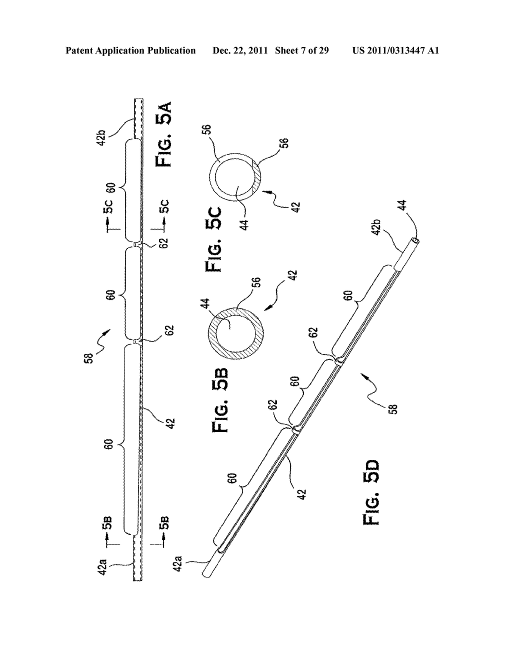 SYSTEM AND METHOD FOR MECHANICALLY POSITIONING INTRAVASCULAR IMPLANTS - diagram, schematic, and image 08
