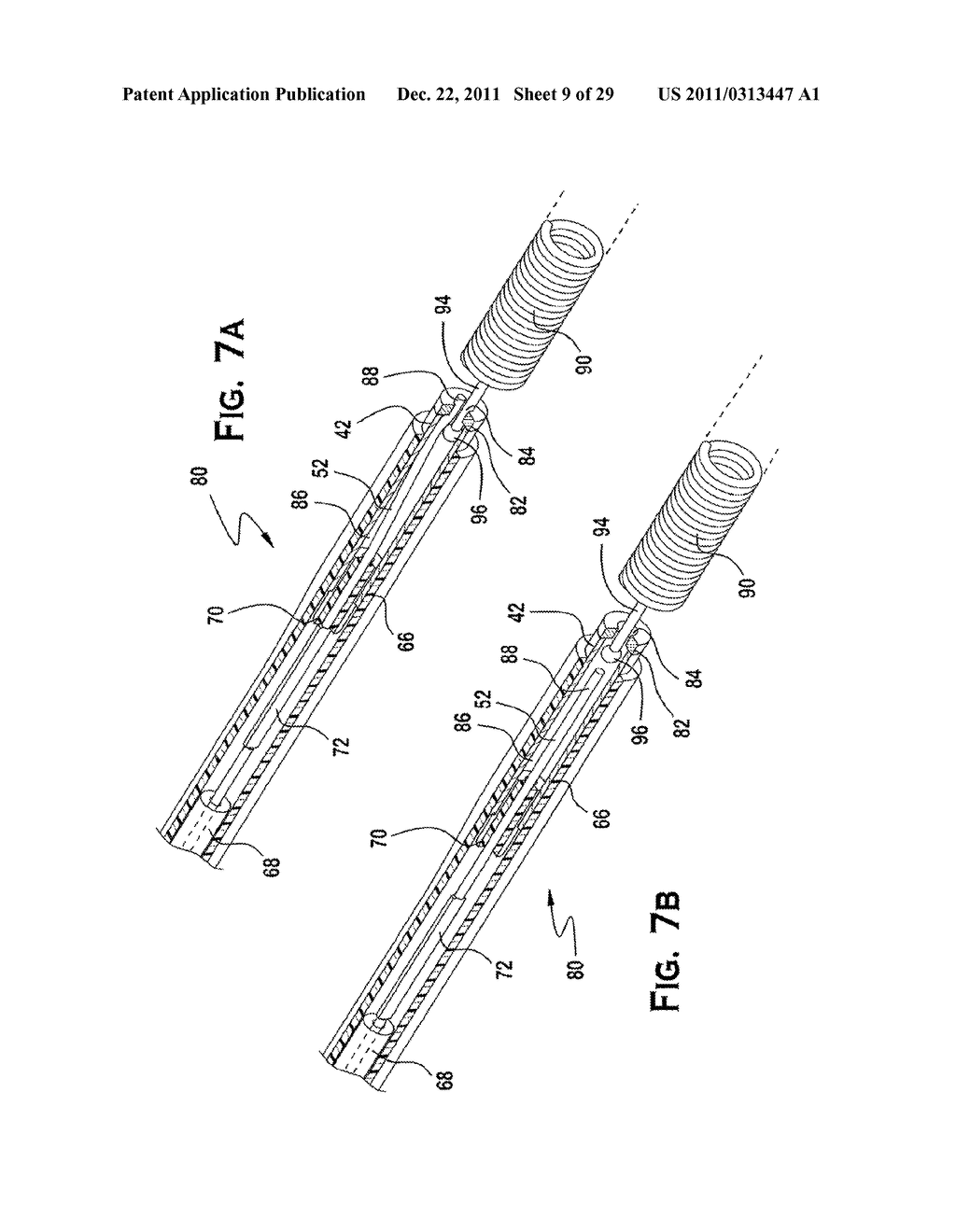 SYSTEM AND METHOD FOR MECHANICALLY POSITIONING INTRAVASCULAR IMPLANTS - diagram, schematic, and image 10