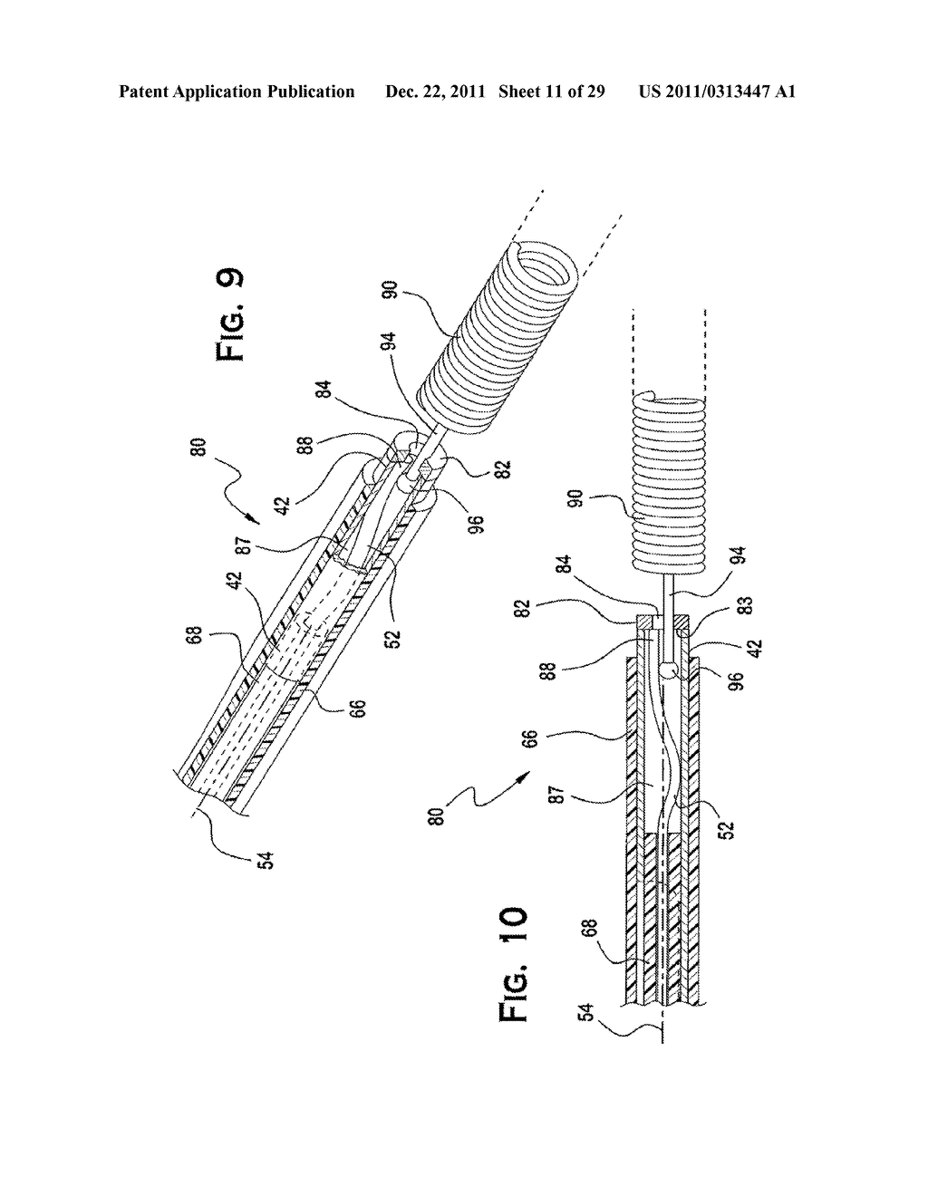 SYSTEM AND METHOD FOR MECHANICALLY POSITIONING INTRAVASCULAR IMPLANTS - diagram, schematic, and image 12