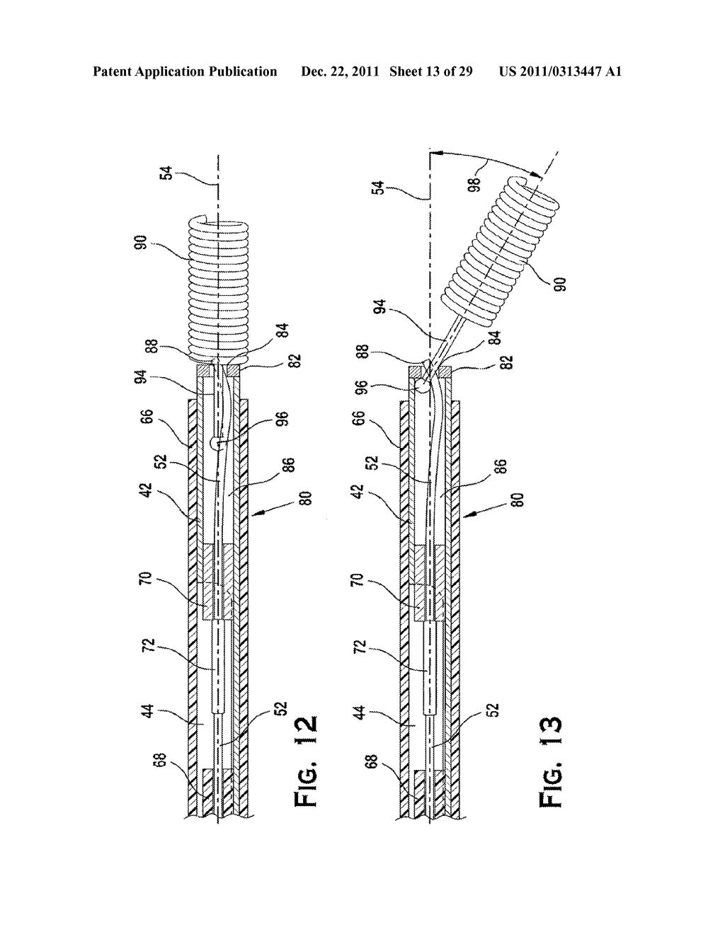 SYSTEM AND METHOD FOR MECHANICALLY POSITIONING INTRAVASCULAR IMPLANTS - diagram, schematic, and image 14